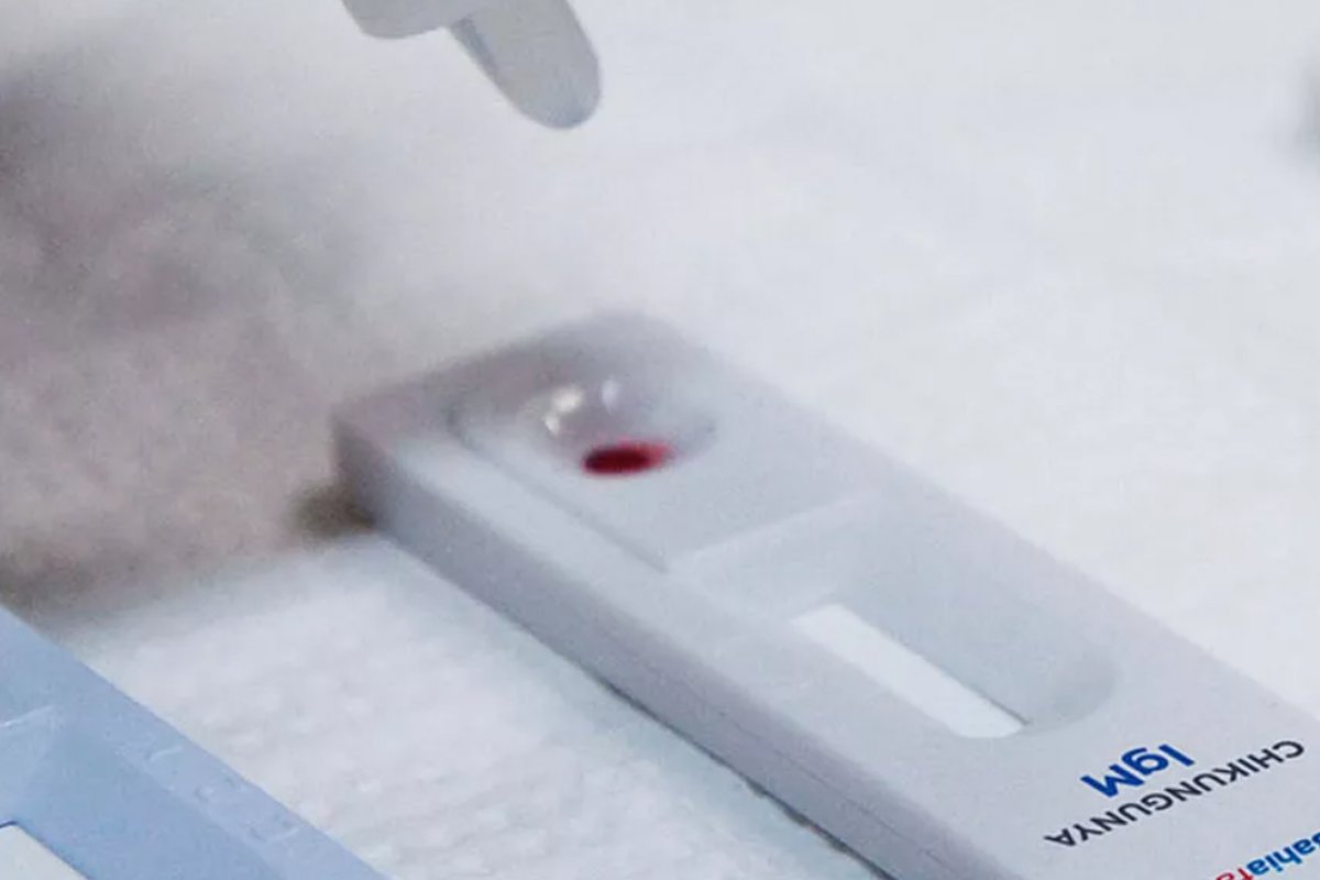 Bahia suspende análises de casos de dengue e chikungunya após falta de insumos