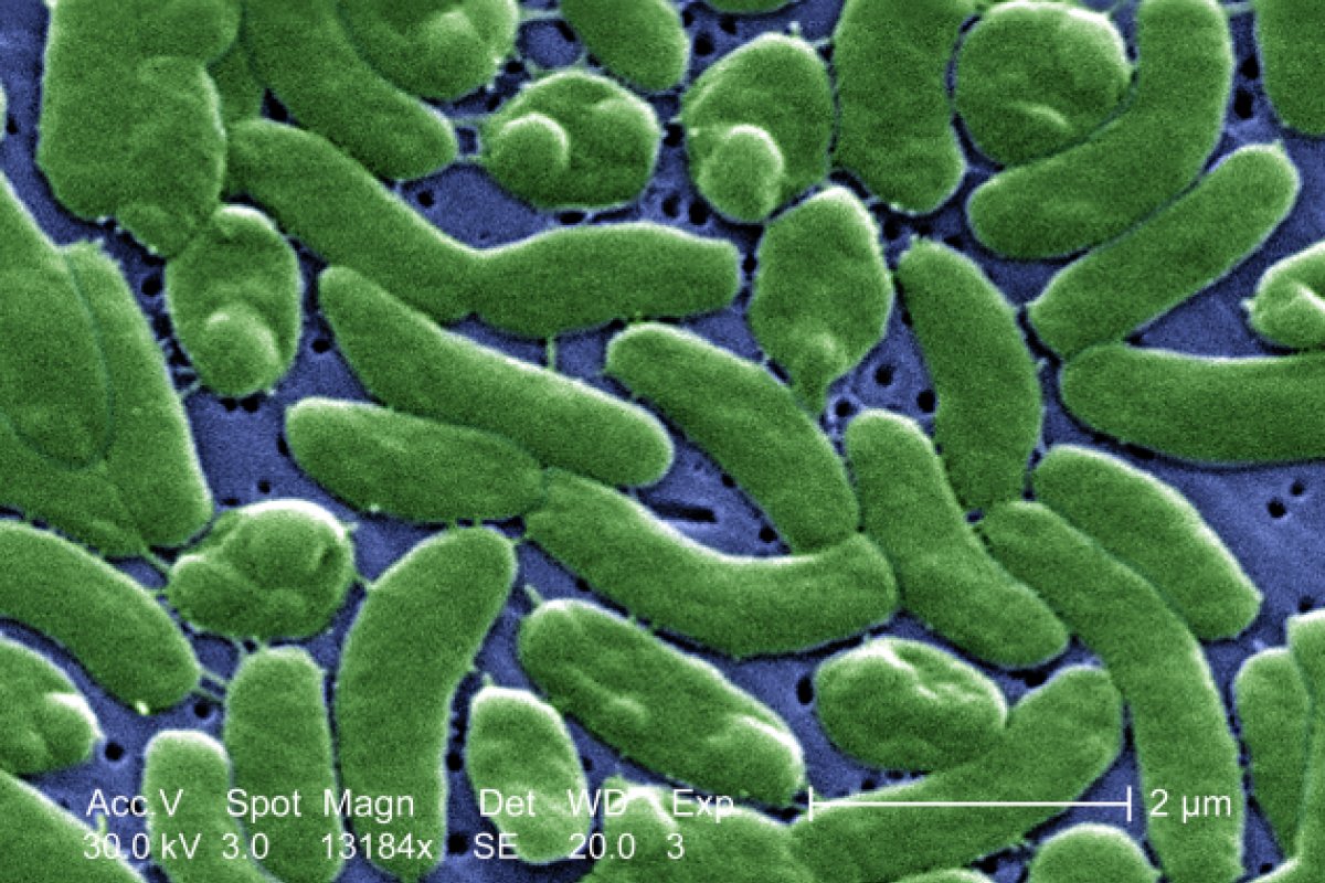 Bactéria rara mata 3 pessoas nos Estados Unidos