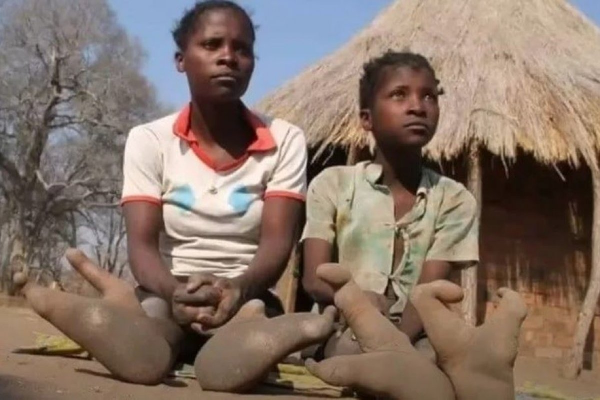 Vídeo: tribo africana é conhecida como 'Povo Avestruz' por mutação genética nos pés
