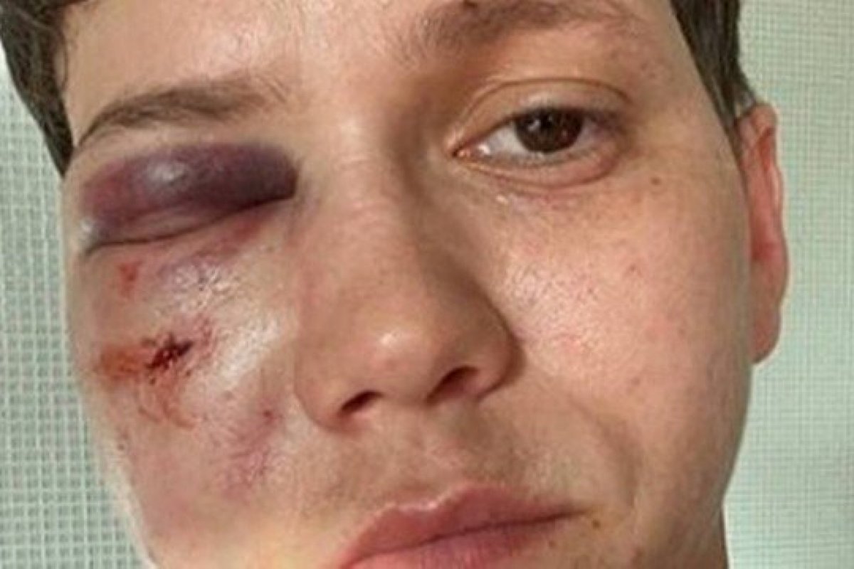 Suspeito de agredir Youtuber diz que agiu em legítima defesa