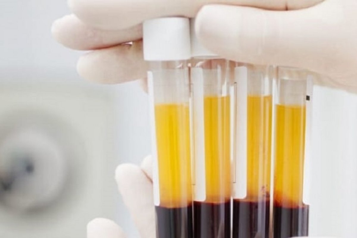 Votação da PEC do plasma na CCJ é adiada pela segunda vez