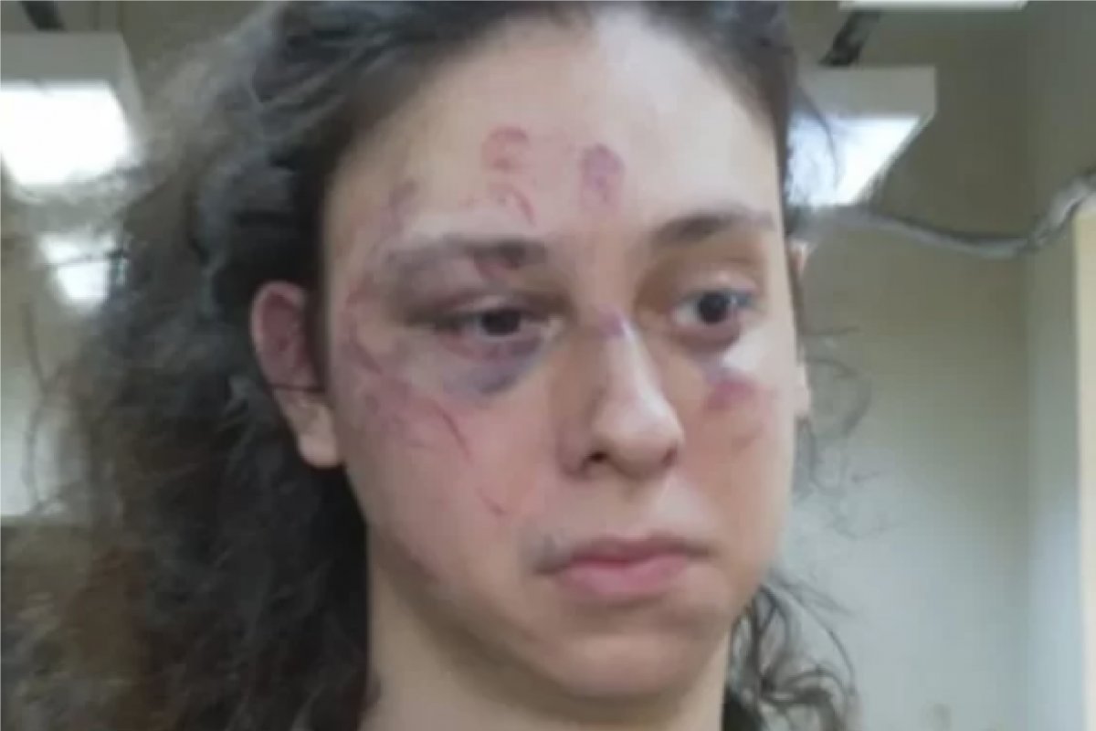 Vídeo: ator Victor Meyniel é espancado em ato de homofobia no Rio de Janeiro