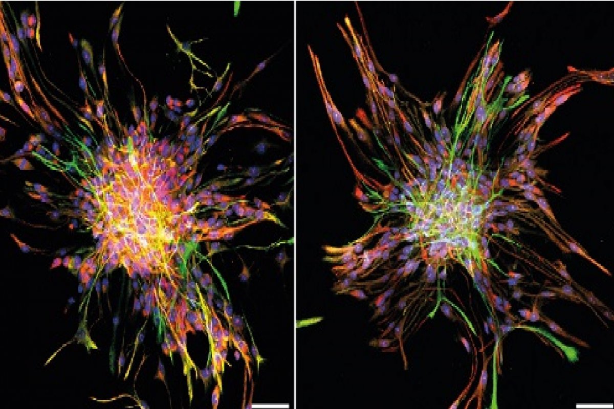 Estudo revela impactos da Toxoplasmose Congênita na formação cerebral de bebês