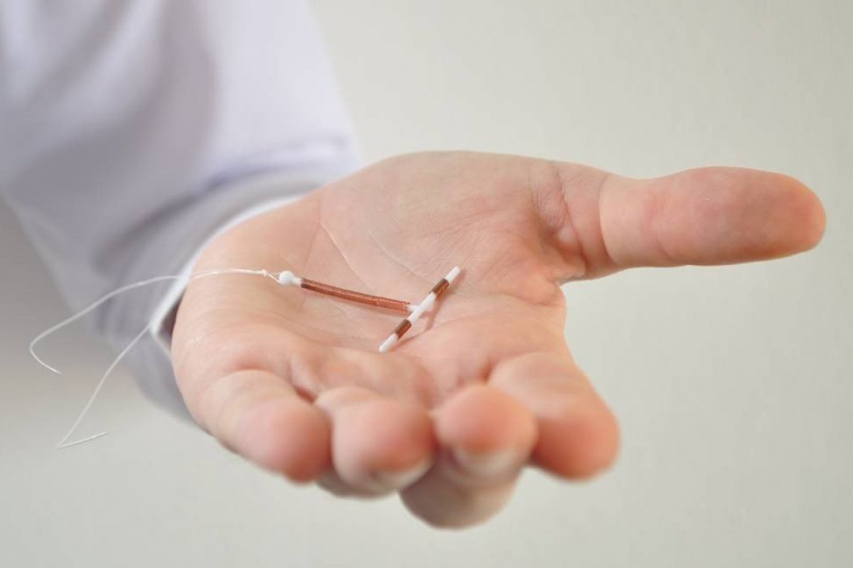 MP proíbe enfermeiros de inserirem DIU em pacientes