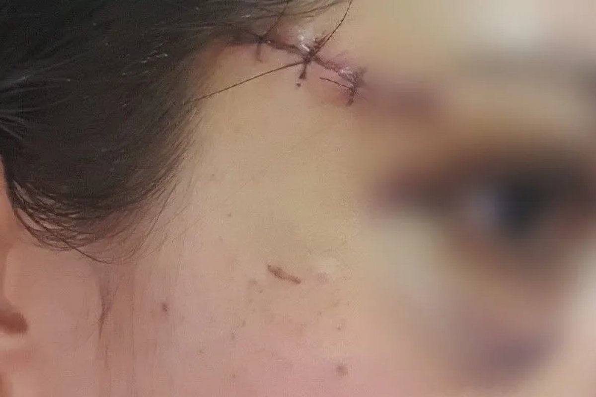 Defesa da policial federal baleada por Roberto Jefferson, pede R$ 1 milhão de indenização