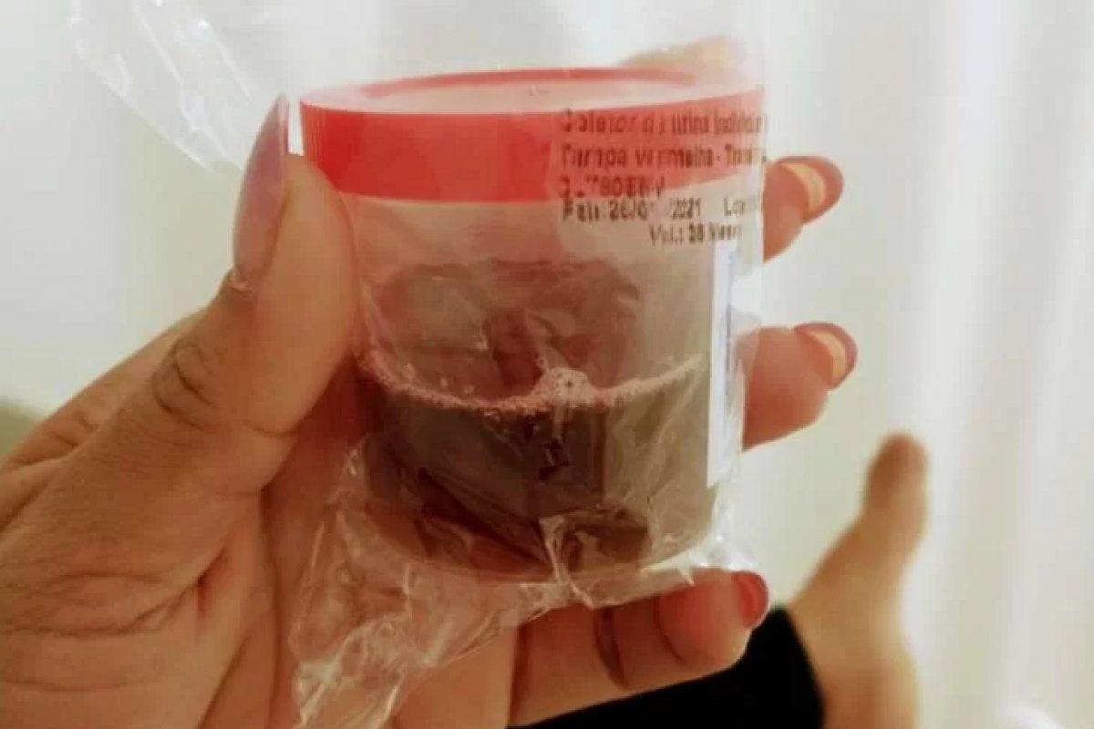 Estado do Amazonas soma quase 50 casos da doença da urina preta