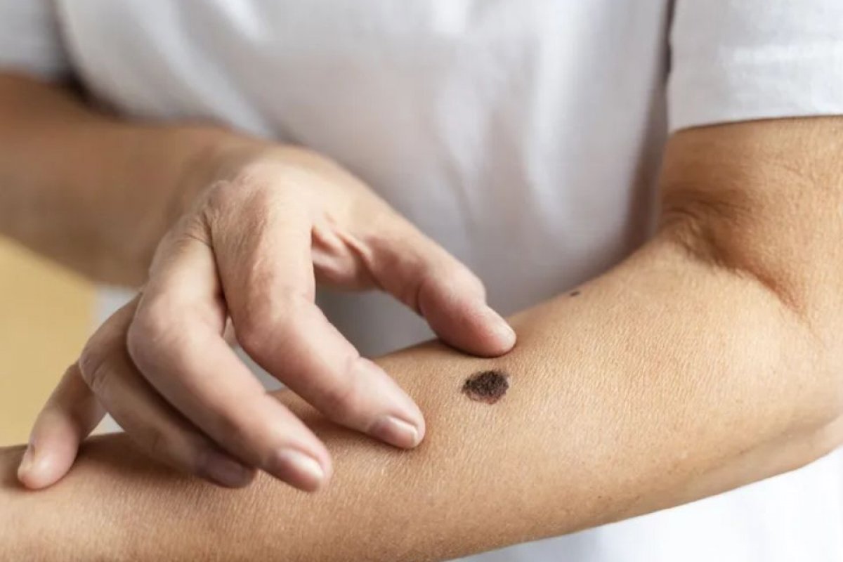 Mulher descobre que não tinha câncer após fazer 2 anos de tratamento