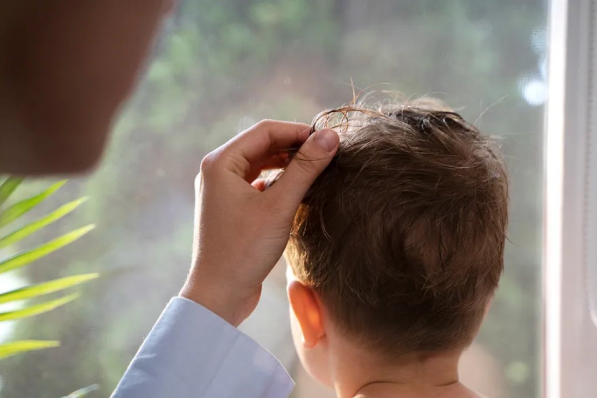 Queda de cabelo na infância e adolescência pode indicar distúrbio hormonal