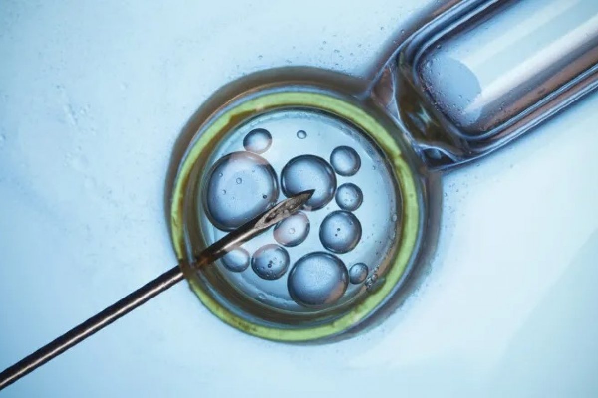 Fertilização in vitro pode prevenir doenças hereditárias