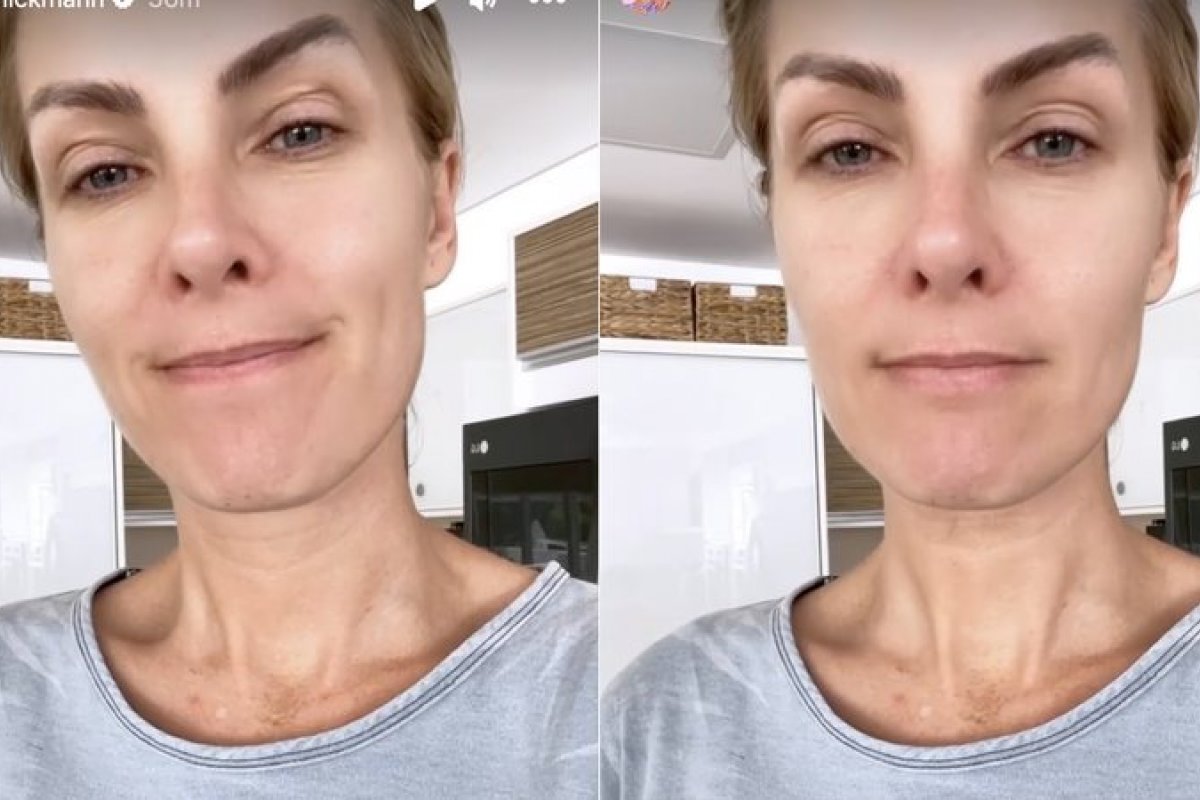 Bastante abalada, Ana Hickmann volta à internet: 'Muita coisa que estava machucando'