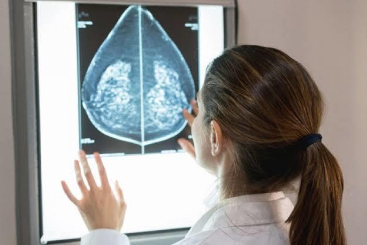 Inteligência artificial é mais precisa que médicos em diagnósticos de câncer de mama