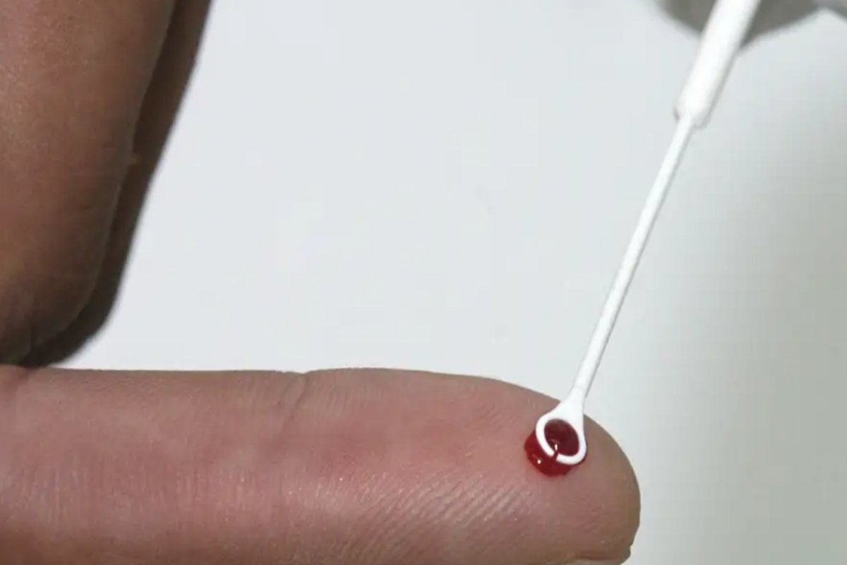 Bahia apresenta redução nos números de Aids em 2023, aponta Sesab