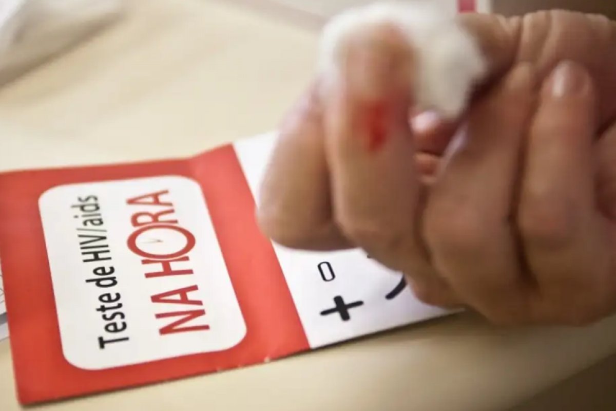 No Brasil, 190 mil pessoas que sabem ter HIV ainda não iniciaram tratamento