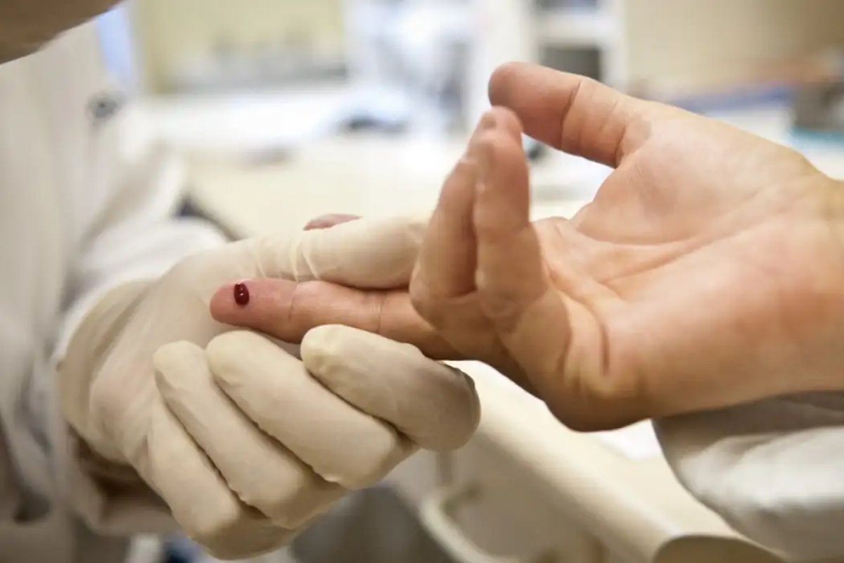 Salvador registrou quase mil casos de HIV em 2023