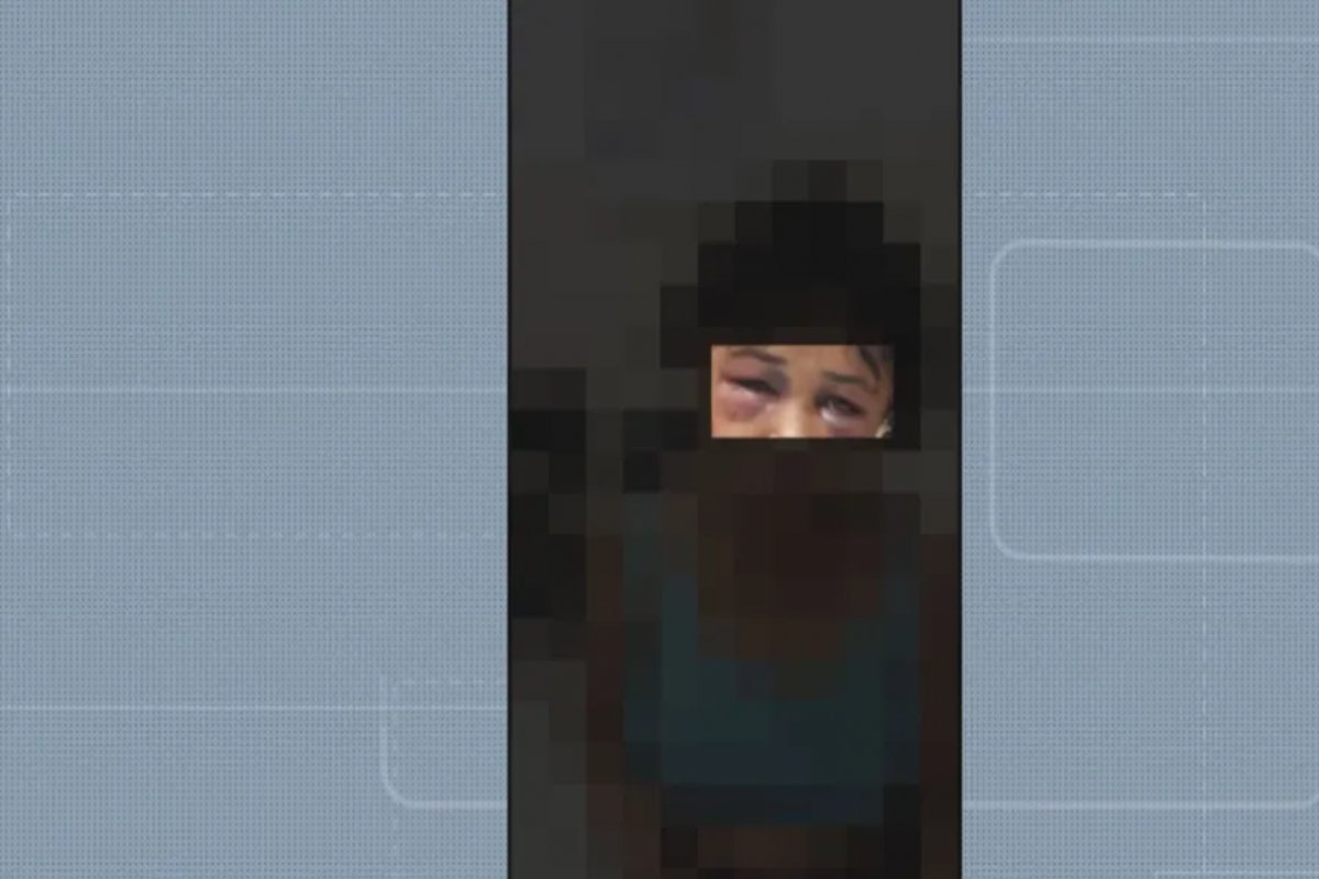 Jovem de 24 anos é agredida e queimada com maçarico pelo companheiro em Salvador