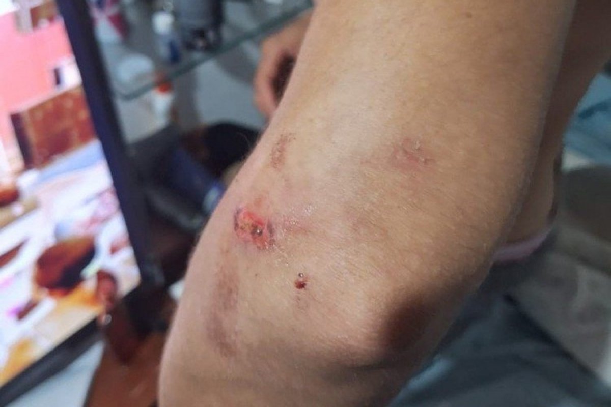 Mulher trans é espacanda em Maceió após pedir que som fosse abaixado