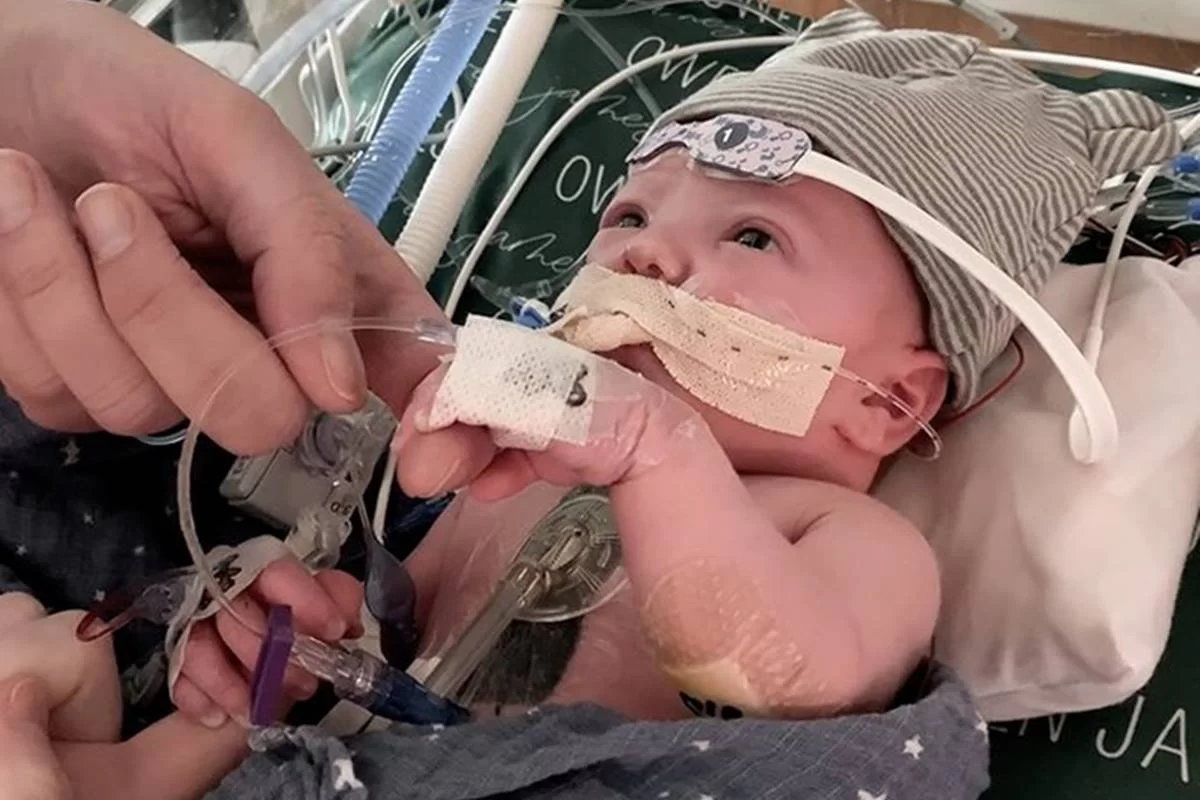 Bebê recebe primeiro transplante parcial de coração no mundo