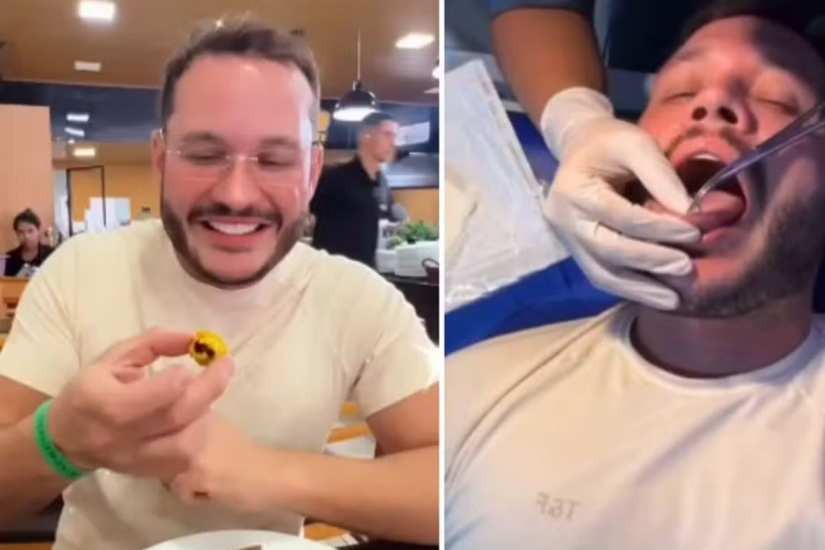 Vídeo: Influenciador cearense Delano Cruz retira mais de 50 espinho na língua após consumir pequi