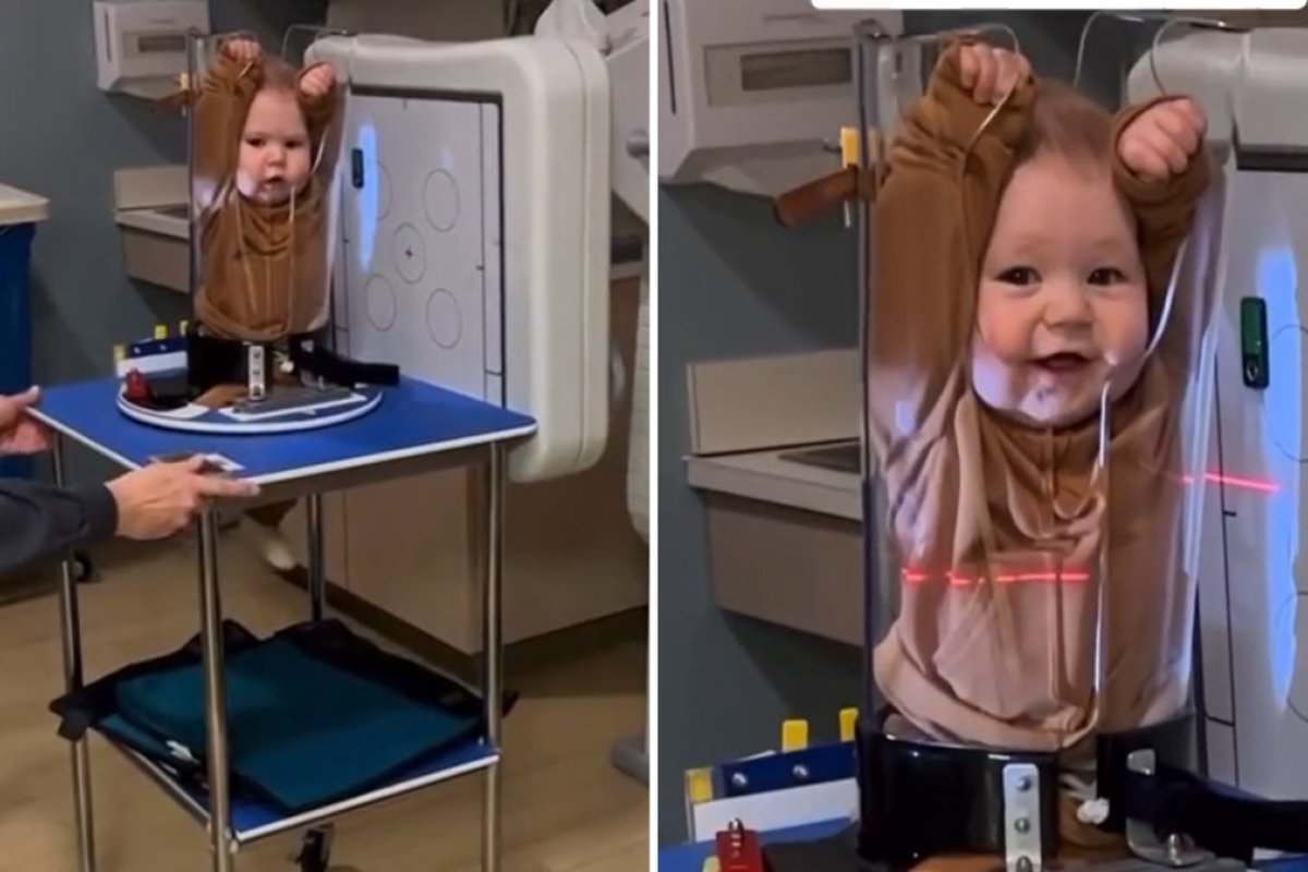 Vídeo: conheça o Pigg-O-Stat, técnica que 'espreme' bebês em cilindros para fazer exames de Raio-X