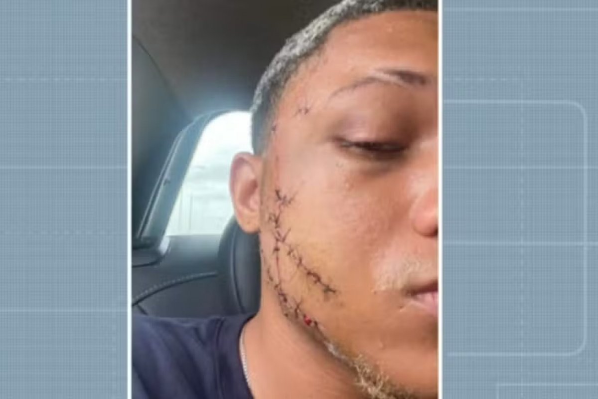 Jovem é agredido com garrafa de vidro ao separar briga em Salvador