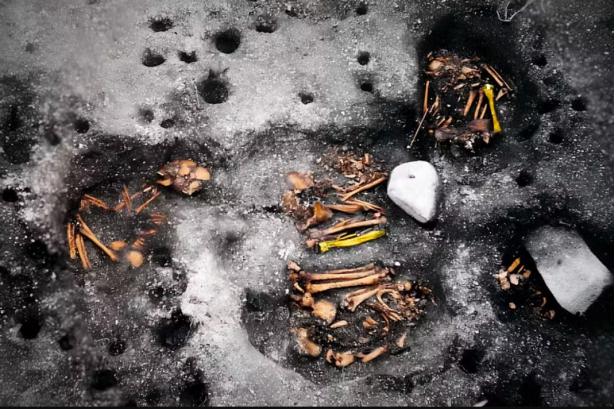 Sífilis pode ter origem brasileira, aponta estudo