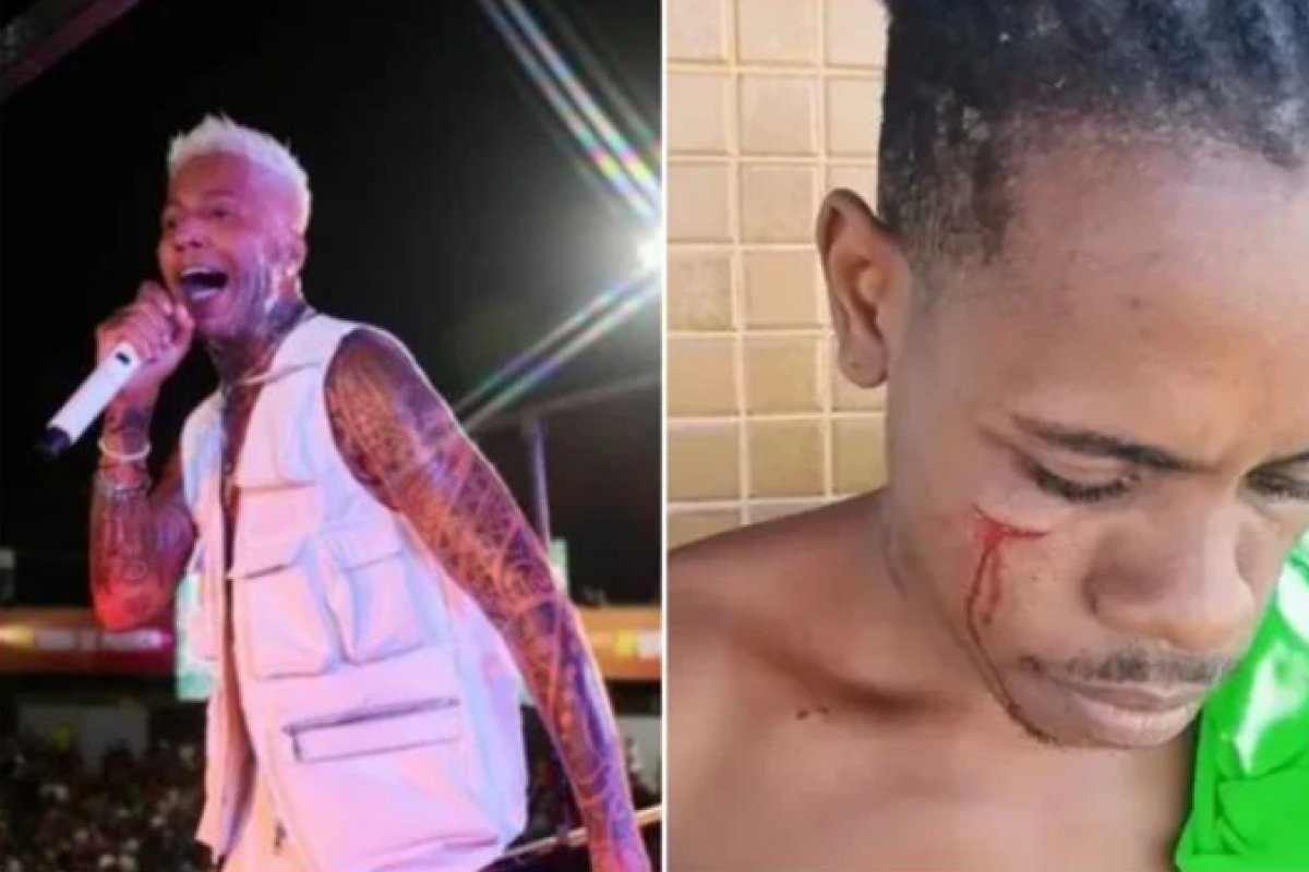 Vídeo: Igor Kannário é acusado de agressão; cantor alega ter defendido filha de assédio
