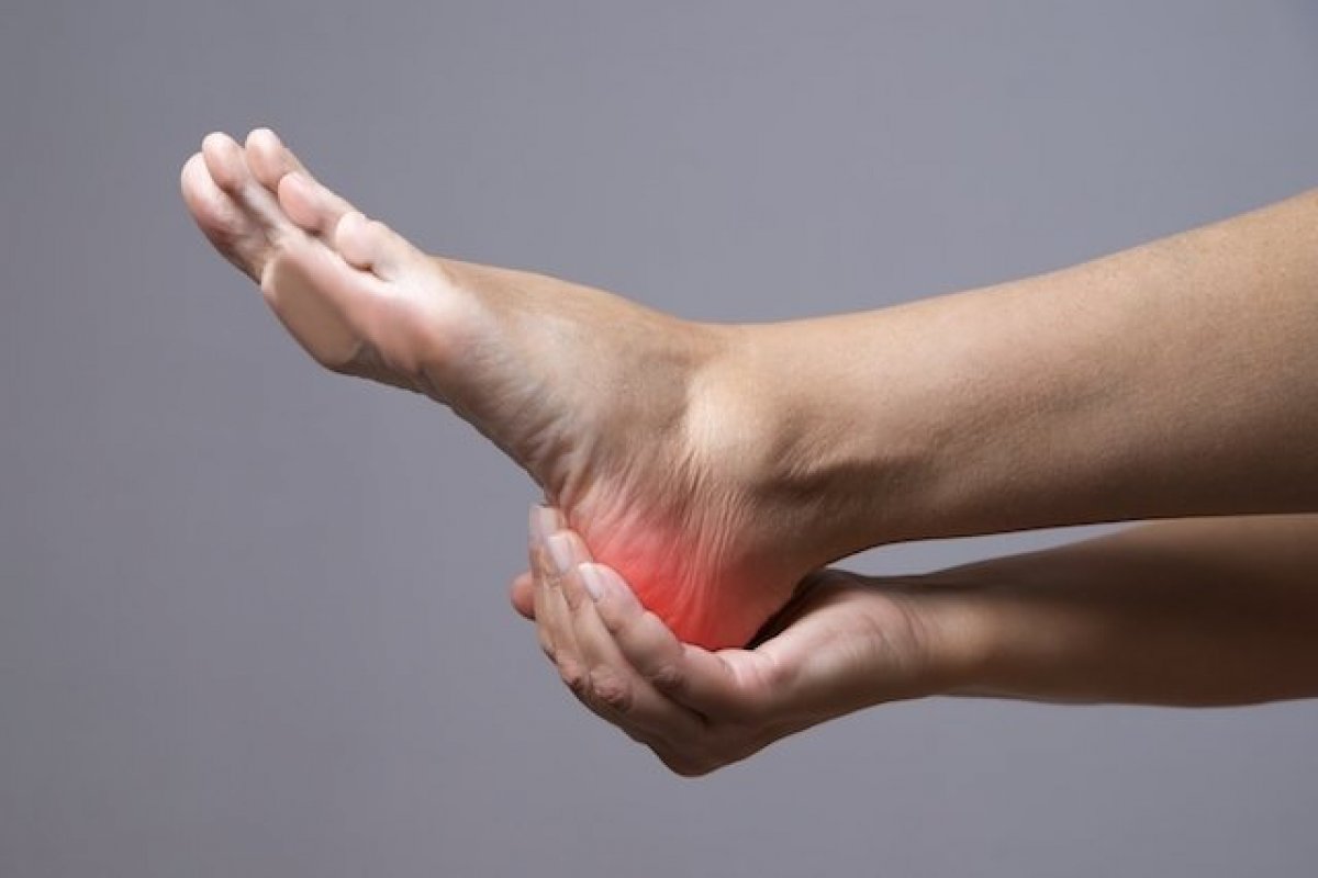 Dor no calcanhar é principal sintoma da fascite plantar!