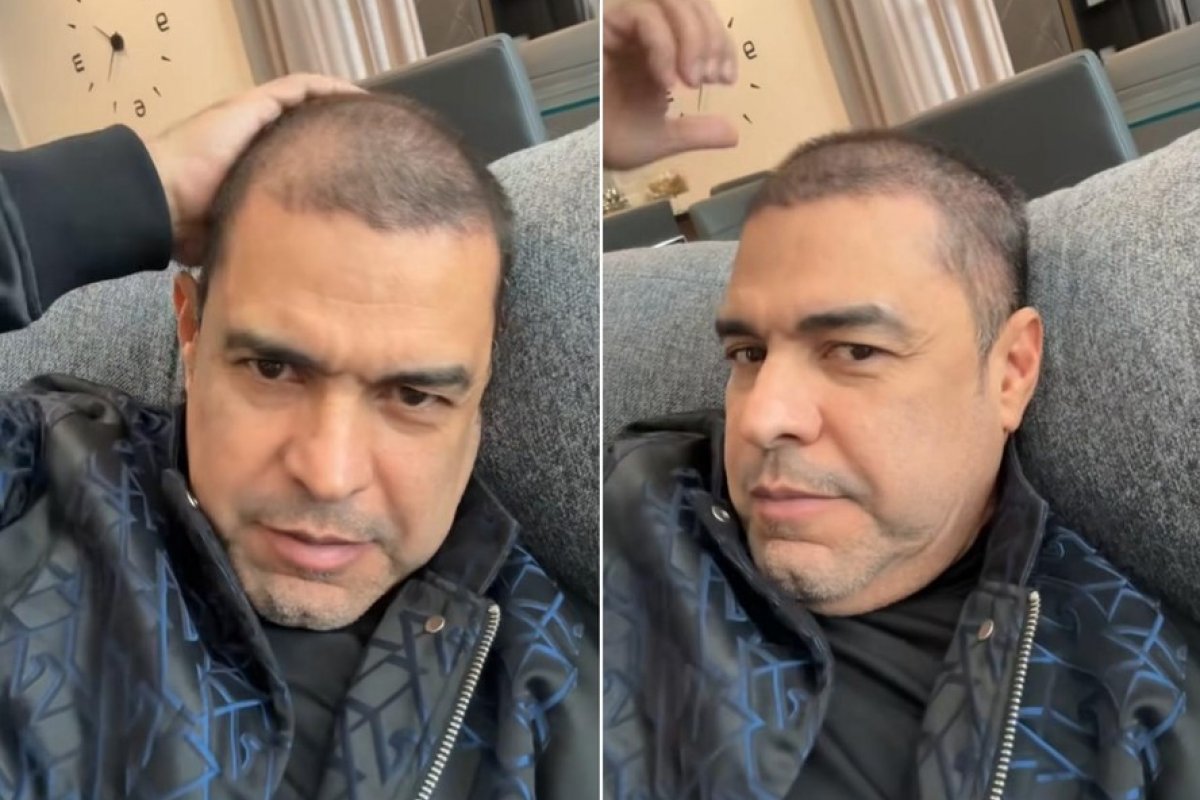 Zezé Di Camargo diz que cabelo ficou 'ralo' após três diagnósticos de Covid!