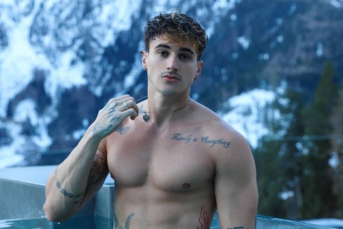 Influencer e tiktoker Alex Mapeli é internado com feridas e febre; médicos não sabem o que é!