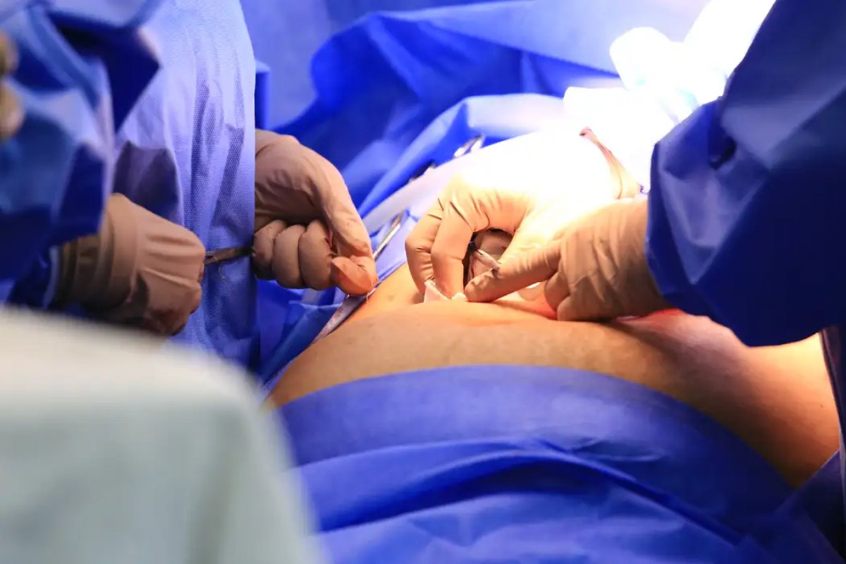 Câmara aprova projeto que obriga publicação de lista de espera do SUS