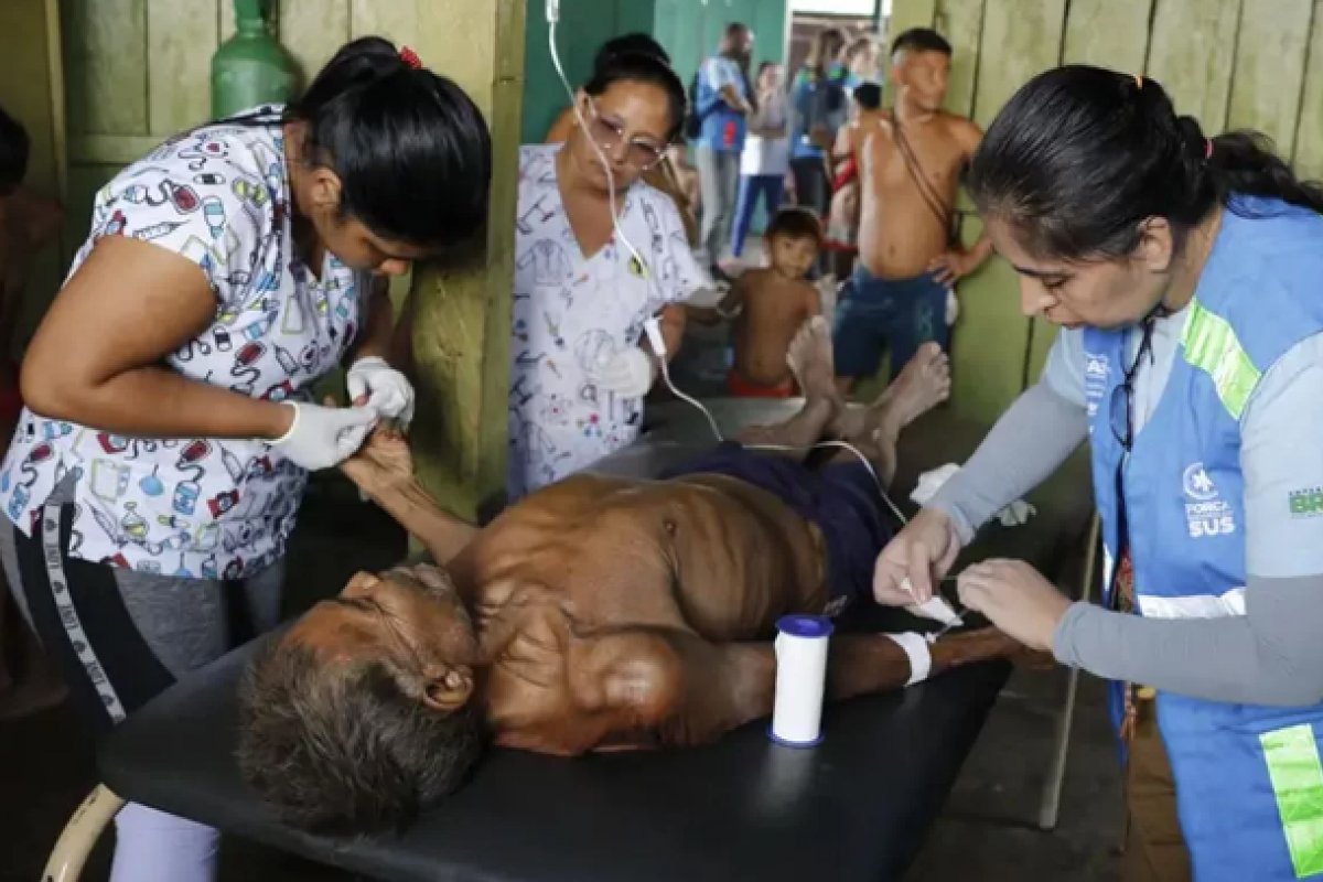 Governo aponta que número de mortes de Yanomamis é mais alto do que o divulgado