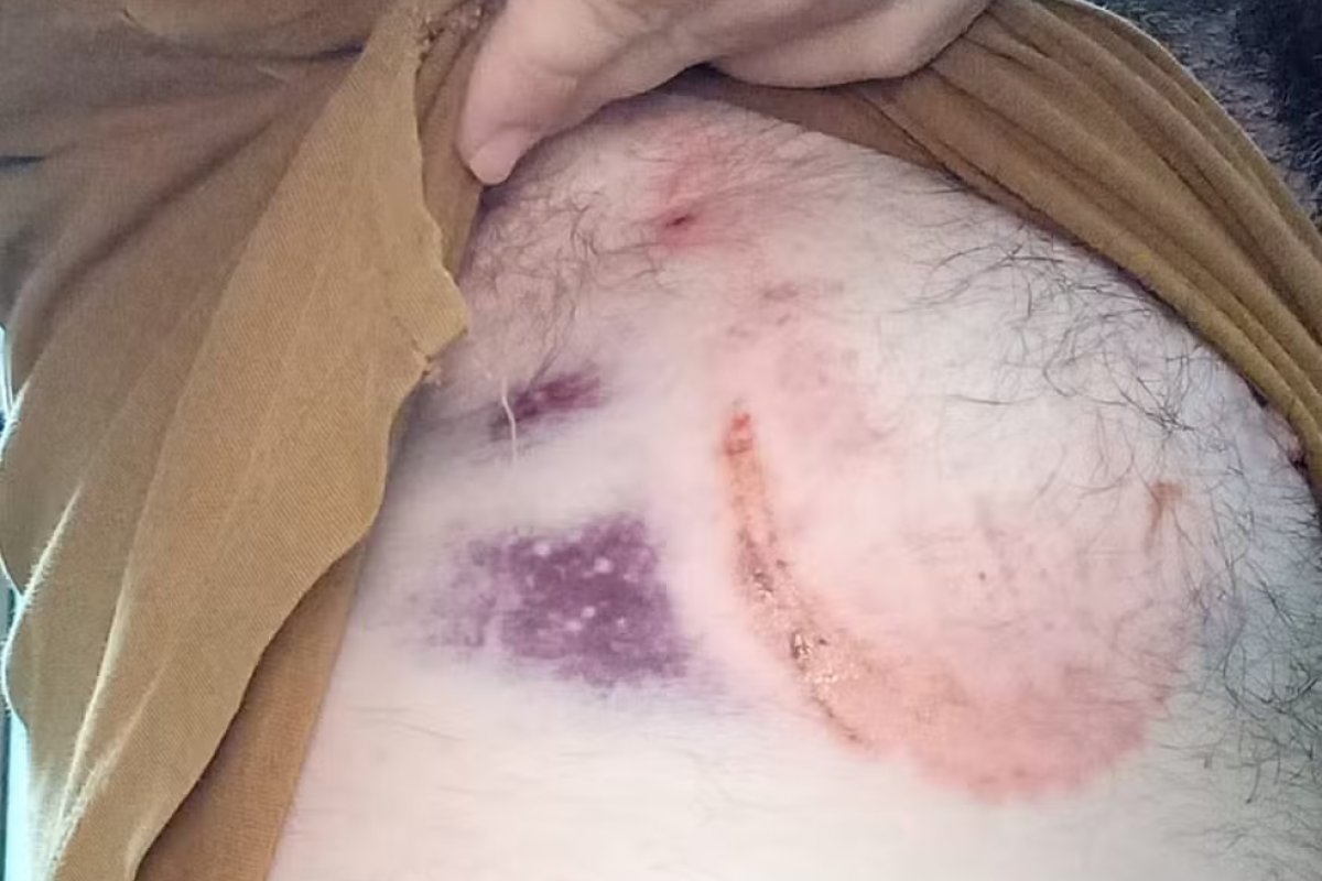 Vereador é mordido por burro em calçada de São Manoel do Paraná