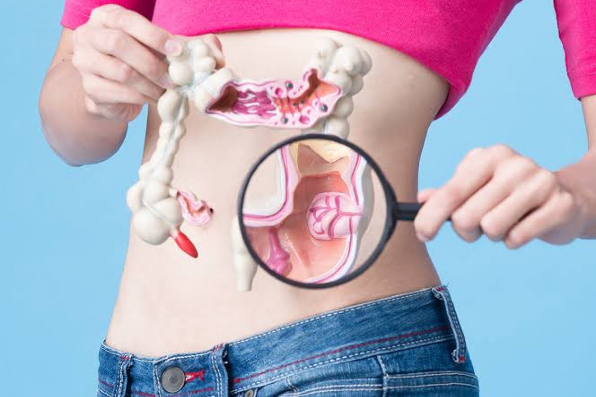 Instituto Ramon Mendes de Coloproctologia promove palestra para alertar sobre o câncer colorretal!