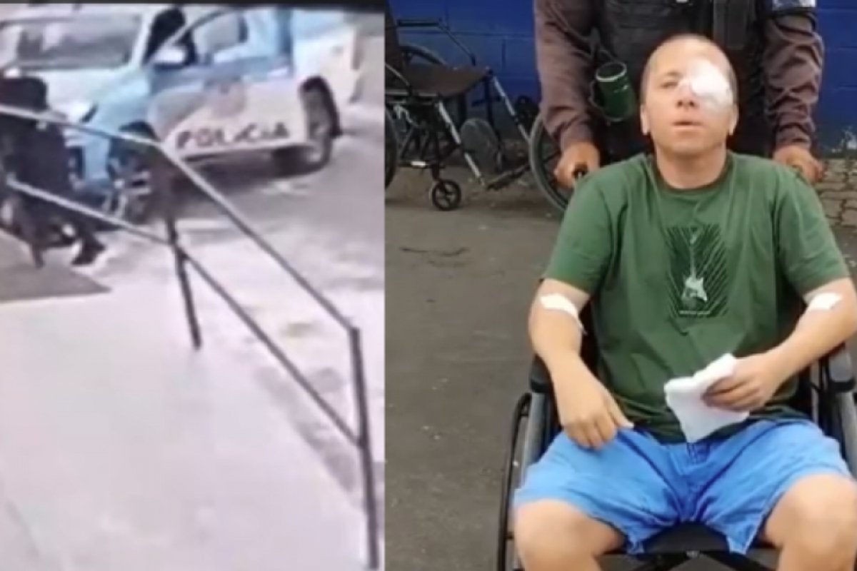 PM é baleado no olho, mata suspeito e dirige até hospital no RJ