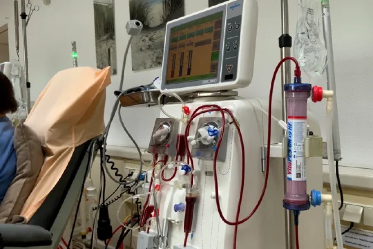 Hemodiálise diária de curta duração é melhor opção para o paciente, aponta estudo