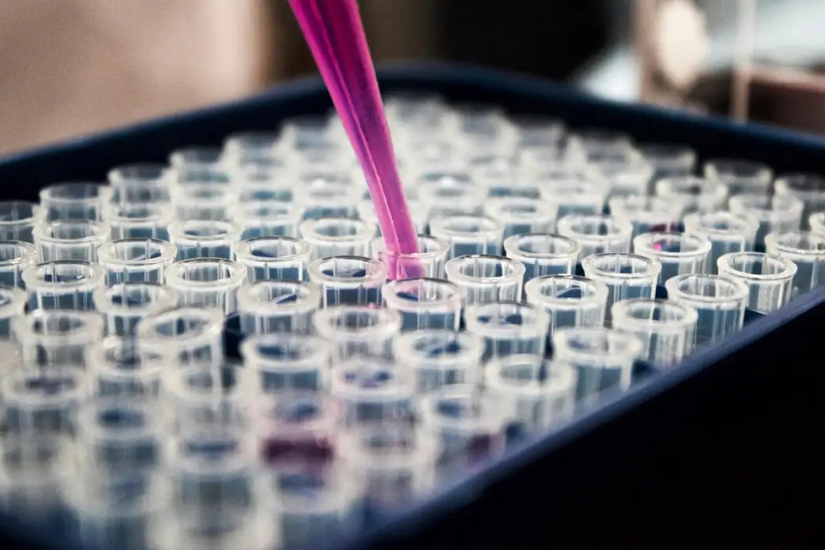 Alzheimer pode ser causado pelo acúmulo de gorduras nas células do cérebro