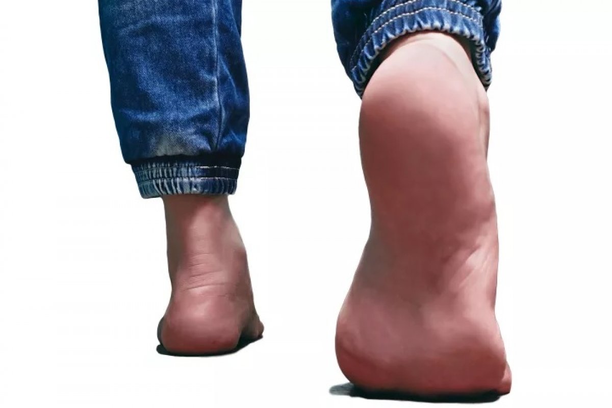 Alimentação não adequada afeta saúde dos pés