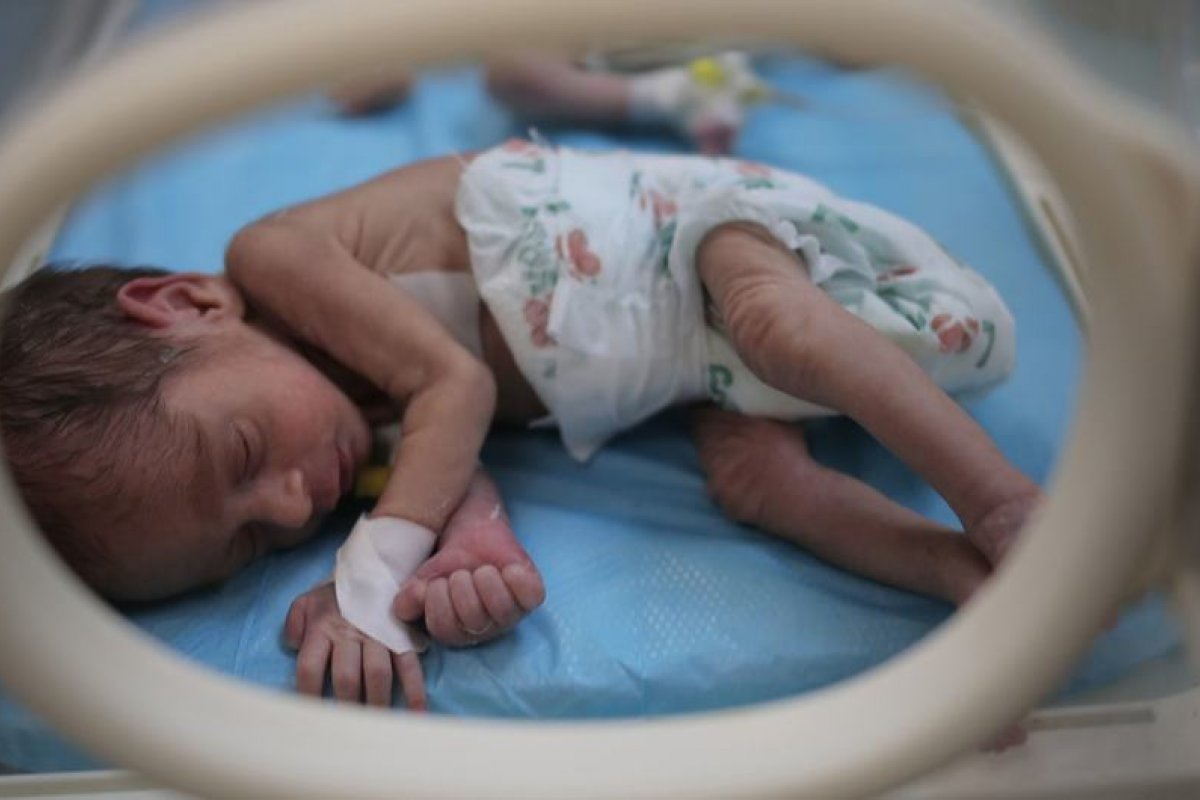 OMS alerta para o aumento de número de recém-nascidos à beira da morte em Gaza