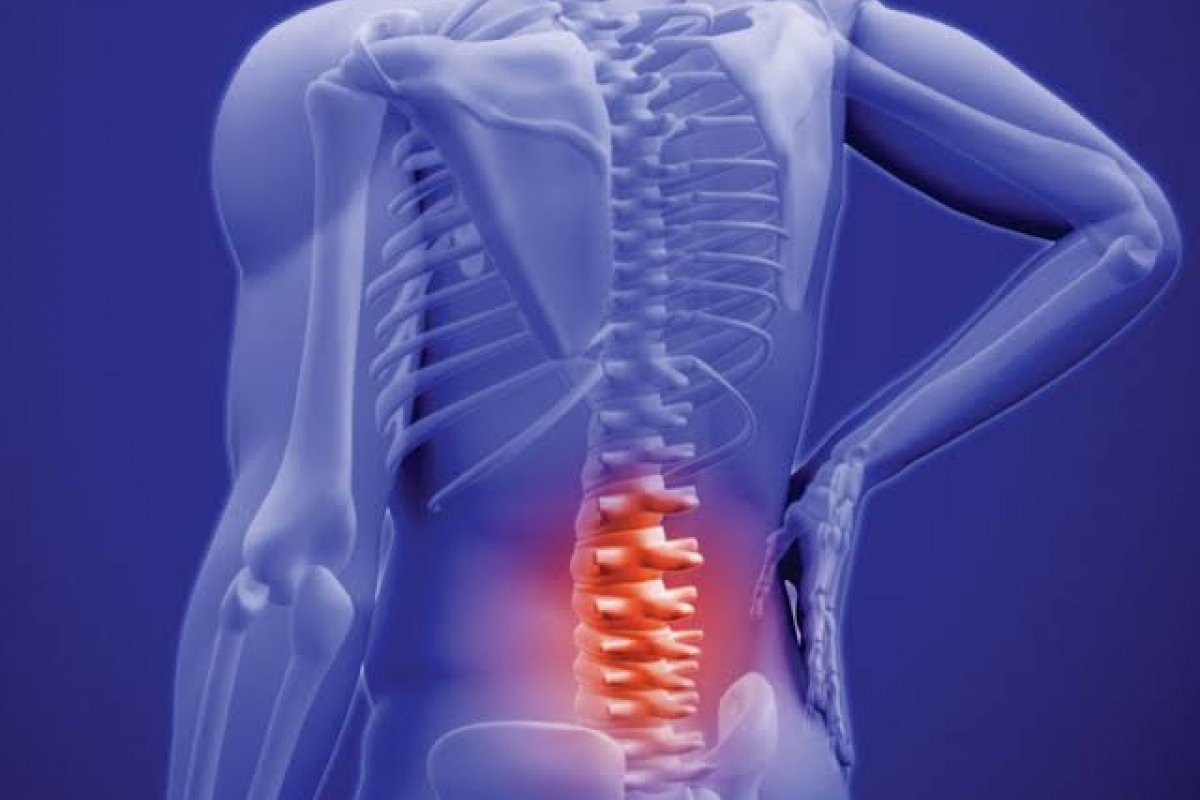 Pilates é considerado melhor método para reduzir dor e incapacidade relacionados à lombalgia, diz estudo!