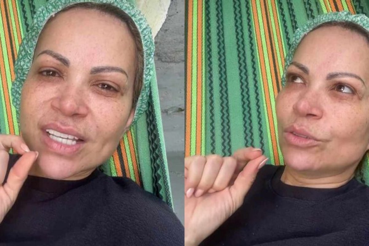 Solange Almeida passa por cirurgia e deixa fãs preocupados!
