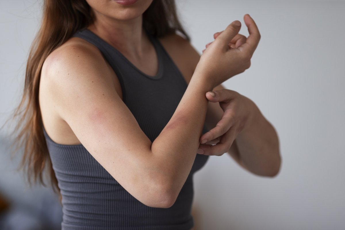 Infectologista dá dicas de como usar repelente contra dengue e outras arboviroses