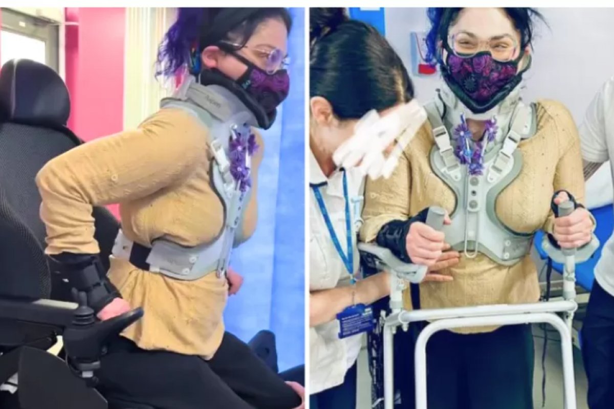 Mulher que vivia deitada por condição rara anda pela 1ª vez após cirurgia