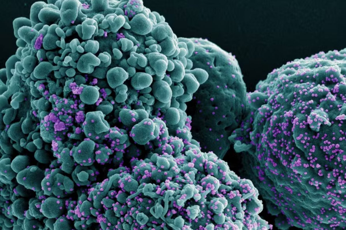 Homem passa 613 dias com Covid e acaba desenvolvendo variante exclusiva da doença