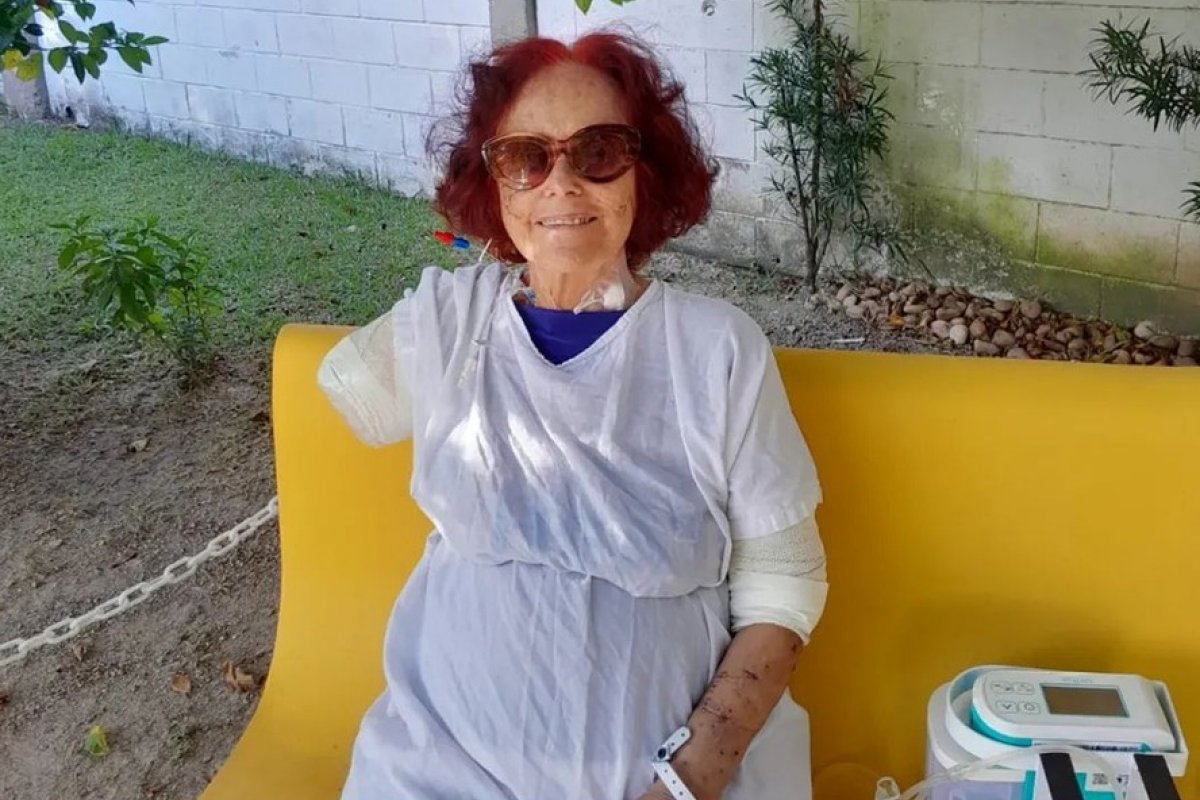 Após ataque de pitbulls, Roseana Murray surge na web e recebe apoio de anônimos e famosos!