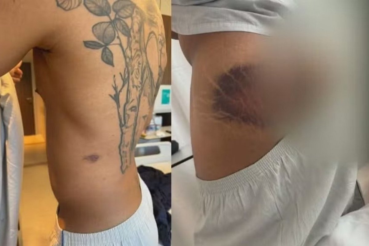 PMs acusados de tortura são soltos por Justiça: "Não oferecem risco"