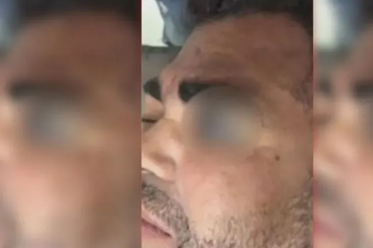 Guardas municipais são suspeitos de agredir homem com pedaço de madeira na Bahia