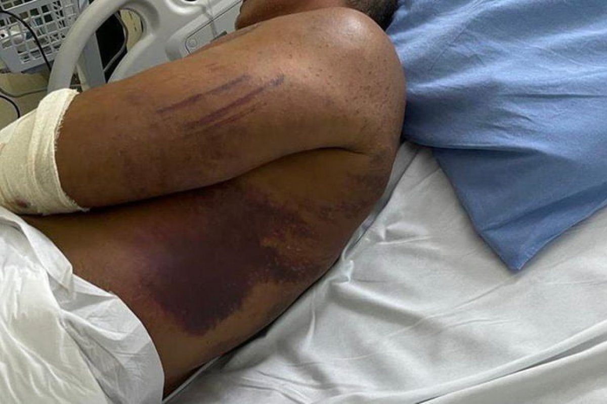 PMs tentaram matar e ocultar crime contra major em Goiás