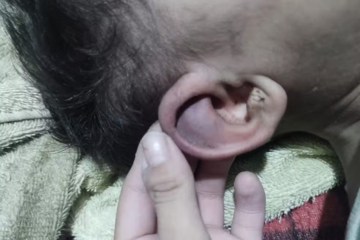 Agressão a bebê de 1 ano em Nova Iguaçu é investigada pela Polícia