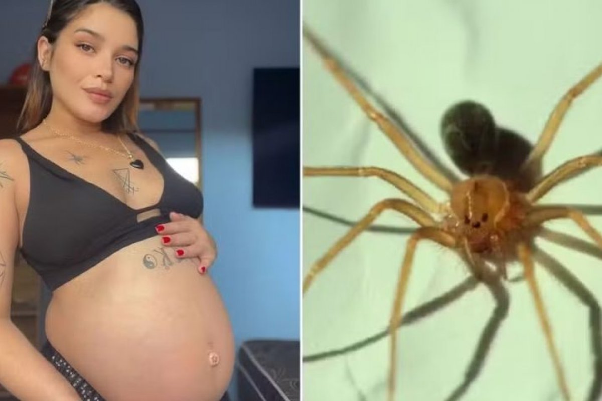 Grávida no oitavo mês de gestação, dá à luz a bebê saudável depois de ter a pele necrosada após picada de aranha