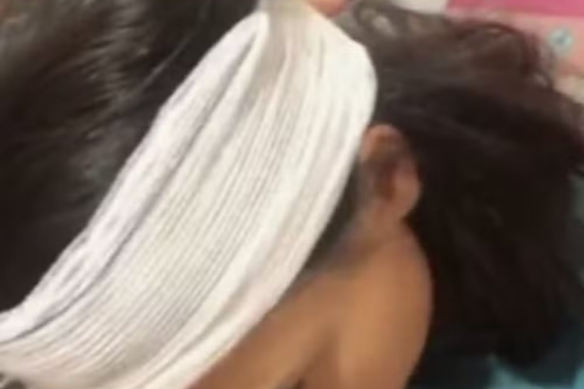 Cachorro se livra de corrente e ataca comerciante autônoma em Jaboatão: "Pensava que ia morrer"